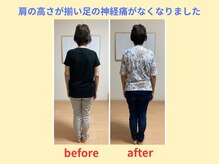 はしもと鍼灸整骨院/整体before→after