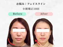 美容整体ウェリナ 中川八田院/小顔矯正/骨盤矯正/痩身整体