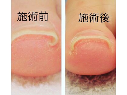 ケセラネイルケアの写真