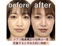 ラプリ 福岡天神店(Raplit)の雰囲気（ フォトのラインQRで無料相談受付中!美鼻/小顔/天神/大名）