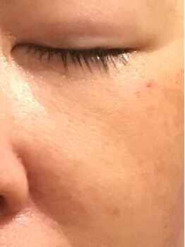 ローズノート(Rose Note)/リブセラ毛穴・赤みケア2