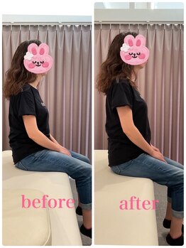 いおり骨盤整体 リブート(RE:BOOT)/姿勢矯正ビフォーアフター