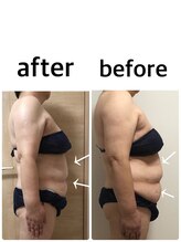 サロンドルフレ(salon de Reflet)/効果絶大！