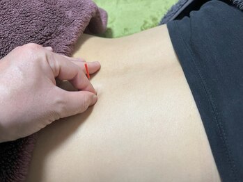 鍼灸療院 泰生堂の写真/妊娠初期～産後まで対応可能です◎つわり、腰痛、むくみ、産後の疲れといったお悩みご相談ください！
