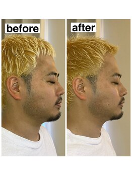 ベルガ 福岡店(Bellega)/