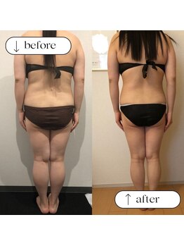 トータルビューティーサロンリア(Li'a)/ビフォー＆アフター