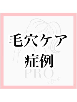 エクラーレ(Eclale)/毛穴ケア症例