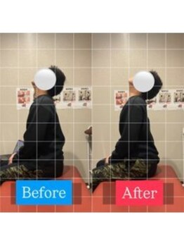 ナオル整体 宮崎院(NAORU整体)/20代男性施術事例【猫背改善】