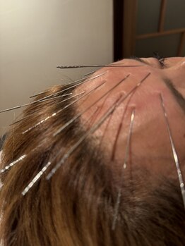 ハリドコロケン(KEN)/パニックにも効果が出てます