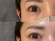 ルッカ(LUKKA)/work by Sakura ラッシュリフト