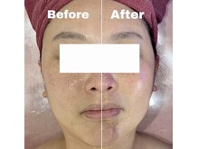 巡り専門店 Body Smile【ヘッドスパ/リンパマッサージ/ストレッチ/痩身/小顔】の雰囲気(美骨フェイシャル★頭蓋骨から歪みを整え、リフトアップ効果◎)