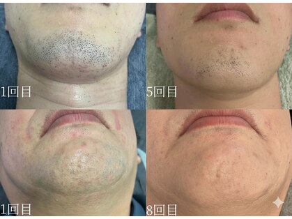 シャイン(SHINE)の写真