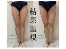 ファスール(Hwasoeur)の雰囲気（結果重視◎国家資格者監修の痩身ケアで冷え・むくみを根本改善）