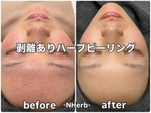 エヌハーブ(NHerb)