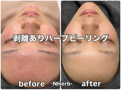 エヌハーブ(NHerb)の写真