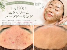 トータルビューティーサロン ヴィヴィエ(ViVier)の雰囲気（フォトギャラリー症例写真あり）