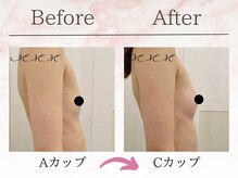 エムエムエム 表参道Luxeサロン(M.M.M)/【バストアップ例】　A→Cカップ