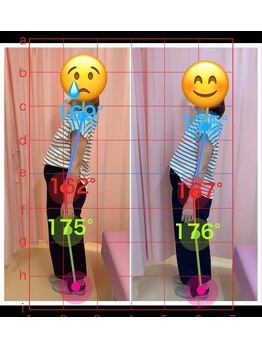 マイティー整骨院 ココア(CoCoa)/マタニティ整体