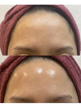 ナンバー19(N°19)/おでこもこの様にツヤツヤ美肌へ