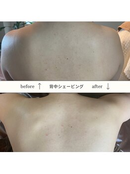 モアプラス(MORE plus)/背中シェービング