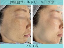 リメイククリニカルビューティー(Remake clinical beauty)/最強のエイジング