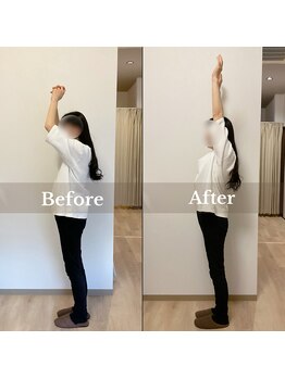 メイリリー(may lily)/◇施術イメージ　50代女性◇