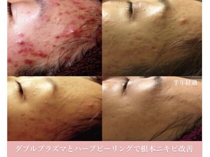 イリゼ(iriser)の写真