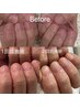 【自爪育成ケア】2回目以降（3週間以降）深爪/爪かみ/理想の爪になれる¥7150