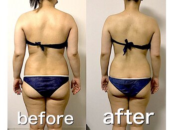 エステサロンクオーツ/【オーダーメイド痩身90分】