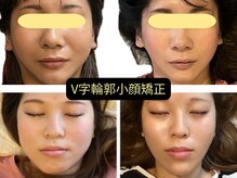 美容整体サロン プライム(Prime)
