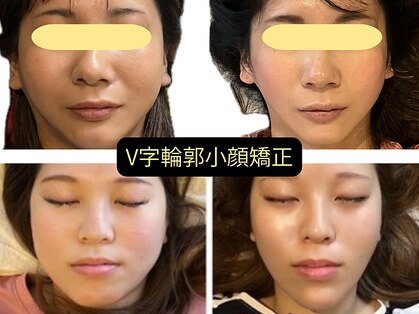 美容整体サロン プライム(Prime)の写真