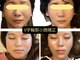 美容整体サロン プライム(Prime)の写真