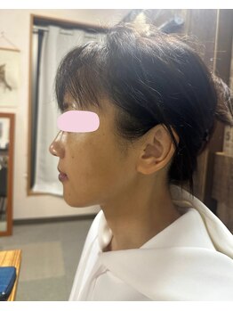 ナギスポット(Nagispot)/After