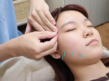 ルクスの写真/【オーナー施術者のみの完全個室・鍼灸サロン】美容鍼で小顔もフェイスライン引き締め＆リフトUPを叶える！