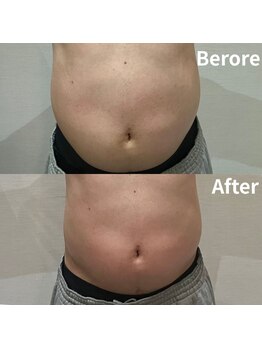 リブラ(LIBRA)/男性のぽっこりお腹も撃退！