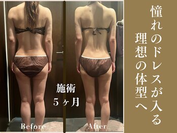 ザ モアナテラス(THE MOANA TERRACE)/理想の体に