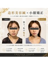 エモシオン トウキョウ(EMOTION TOKYO)/造形美容鍼×小顔矯正