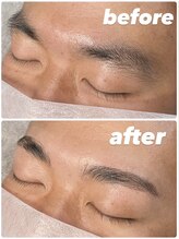 メンズー(MENZOO)/ハリウッドブロウリフト