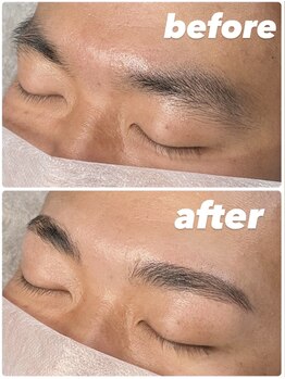 メンズー(MENZOO)/ハリウッドブロウリフト