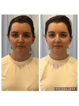 ビュースタイル 梅田 茶屋町店/小顔矯正＆骨盤矯正