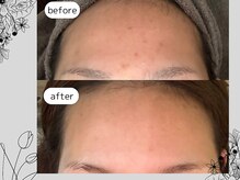 リア(Lia)/ビフォーアフター