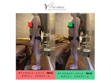 リノレリチア 新町店(Lino'relitzia)の雰囲気（施術メニュー[オリジナルオイルマッサージ/90分] ※女性限定）