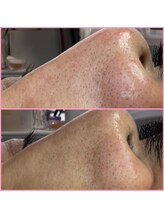 プラスボーテ 幡ヶ谷(plus beaute)/メンズもエステ☆渋谷・北参道