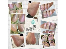 チャティーボックスマユ(Chatty box Mayu)の雰囲気（素足の季節☆かさついたかかとをつるつるに♪）