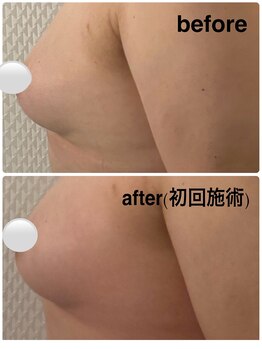 すなお 溝の口(Sunao)/【バストアップ】50代後半お客様