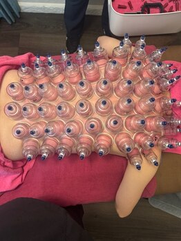 メディカル整体院/吸い玉デトックス