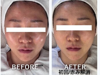 ラカ 明石(Laka)/肌の赤み・くすみ・トーンアップ