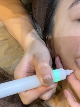 シュエット(CHOUETTE)の写真/【シミ・赤ら顔改善】REVI×シミケアで叶える究極のツヤ肌◎自分史上最高の美しさを引き出します。