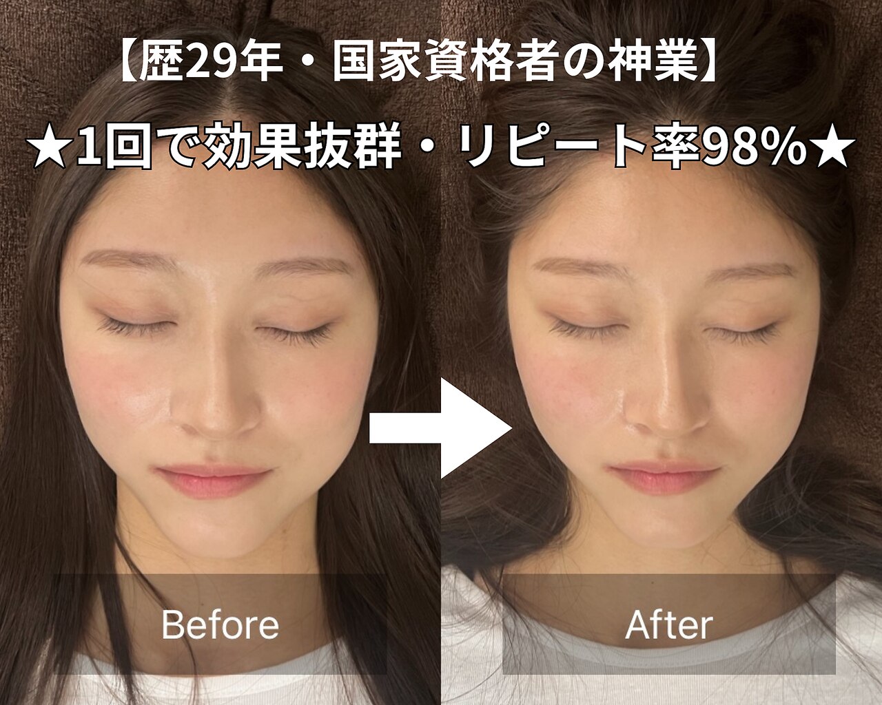 トニック バイ まつもと整骨院鍼灸院(Tonic)｜ホットペッパービューティー