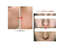 トモニ(TOMONI)の雰囲気(エスグラ優勝の技術を活かし、寄り添った丁寧な施術をご提供。)